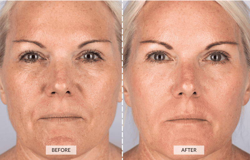 Overnight Rejuvenation | Free Gift + Free Shipping- Today Only!!