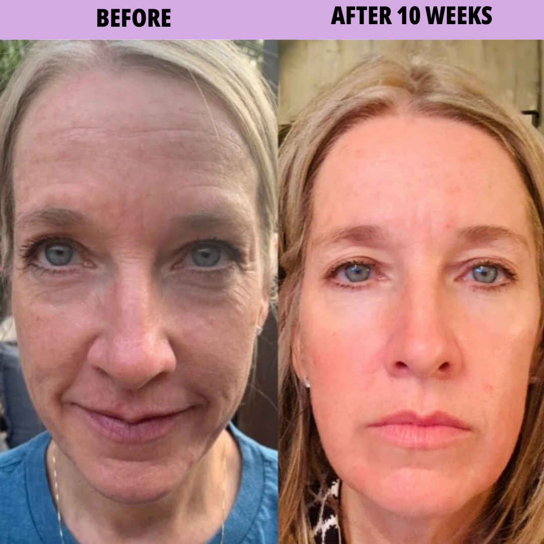 Overnight Rejuvenation | Free Gift + Free Shipping- Today Only!!
