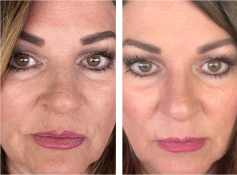 Overnight Rejuvenation | Free Gift + Free Shipping- Today Only!!