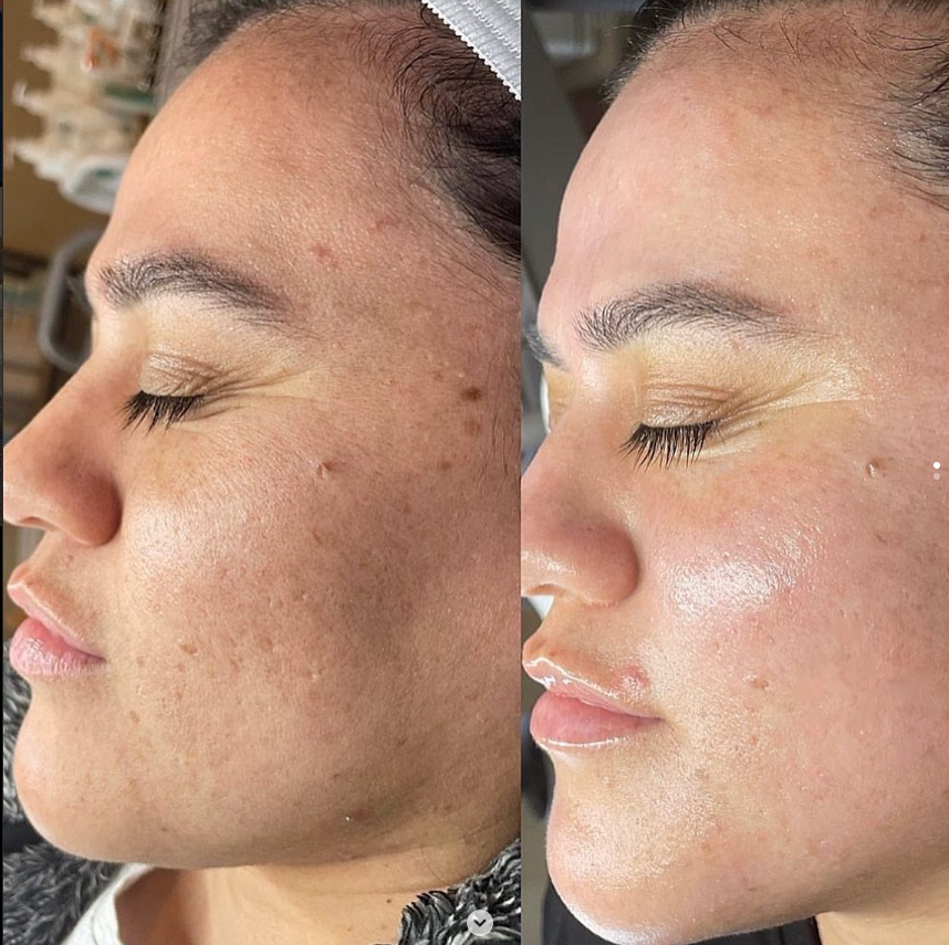 Overnight Rejuvenation | Free Gift + Free Shipping- Today Only!!