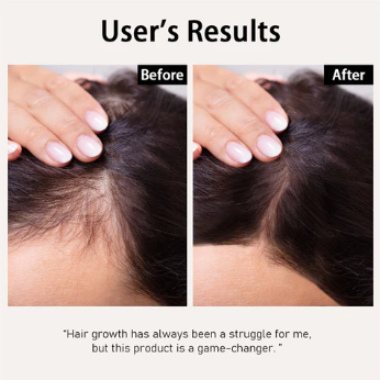 Overnight Rejuvenation | Free Gift + Free Shipping- Today Only!!